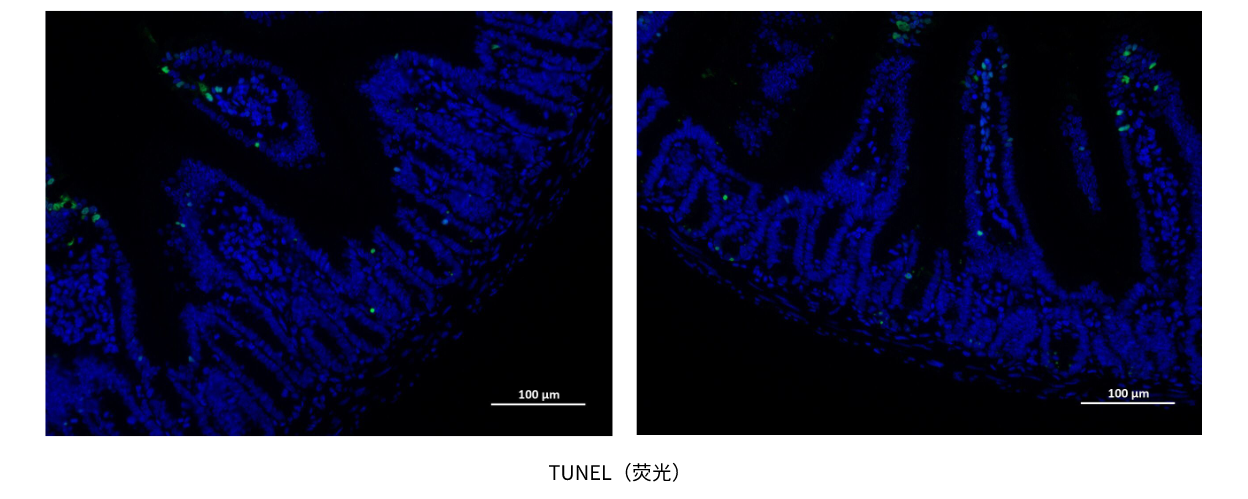 TUNEL（荧光） (2).png