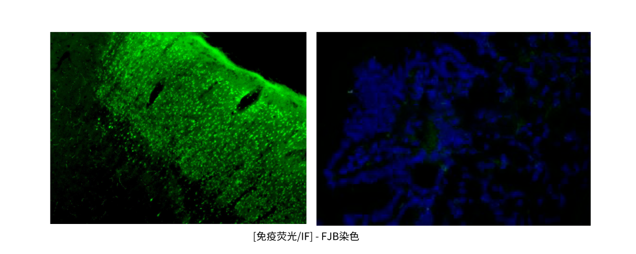 免疫荧光IF- FJB染色.png