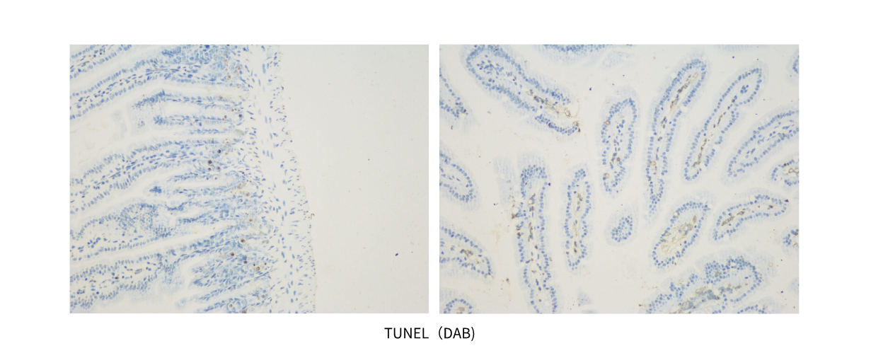 TUNEL（DAB) (2).png