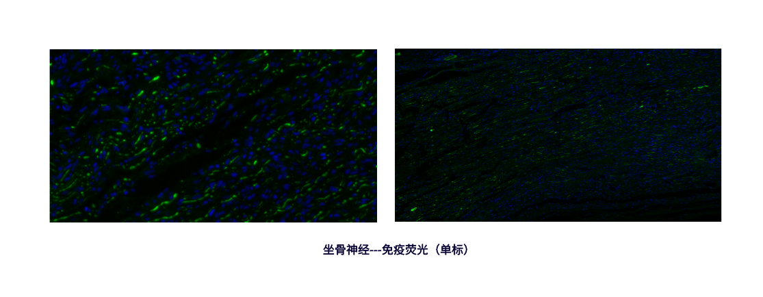 坐骨神经---免疫荧光（单标）.png