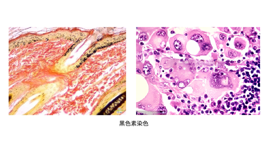 黑色素染色 (2).png