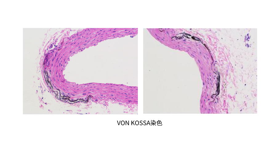 VON KOSSA染色 (2).png