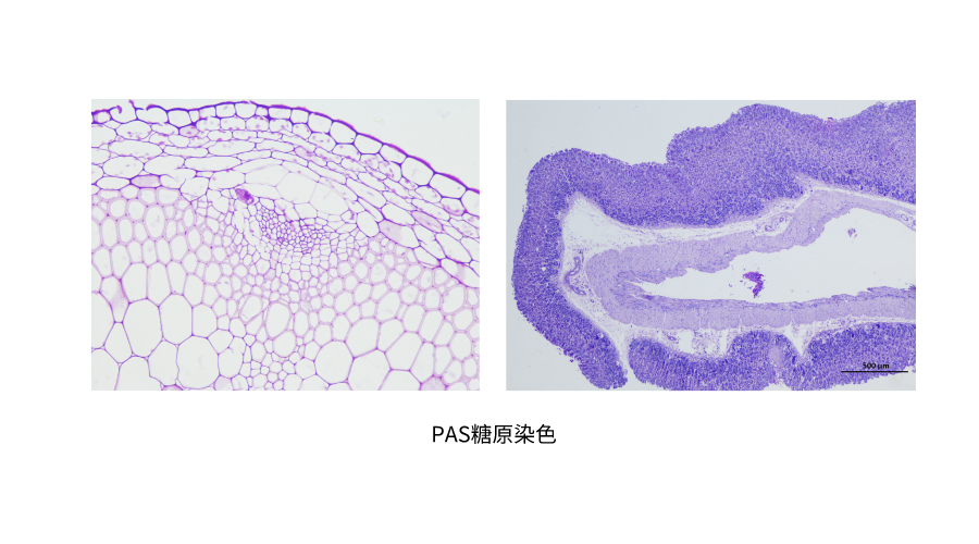 PAS糖原染色 (2).png