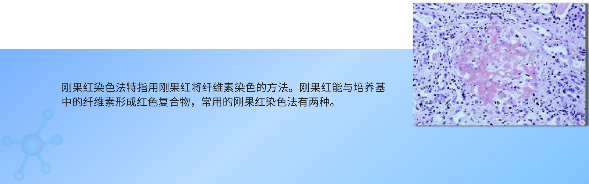 刚果红染色 (1).png