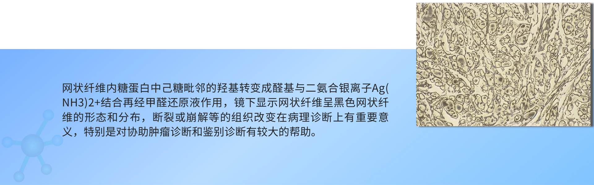 网状纤维染色.png