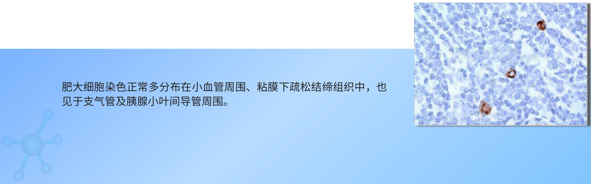 肥大细胞染色 (1).png