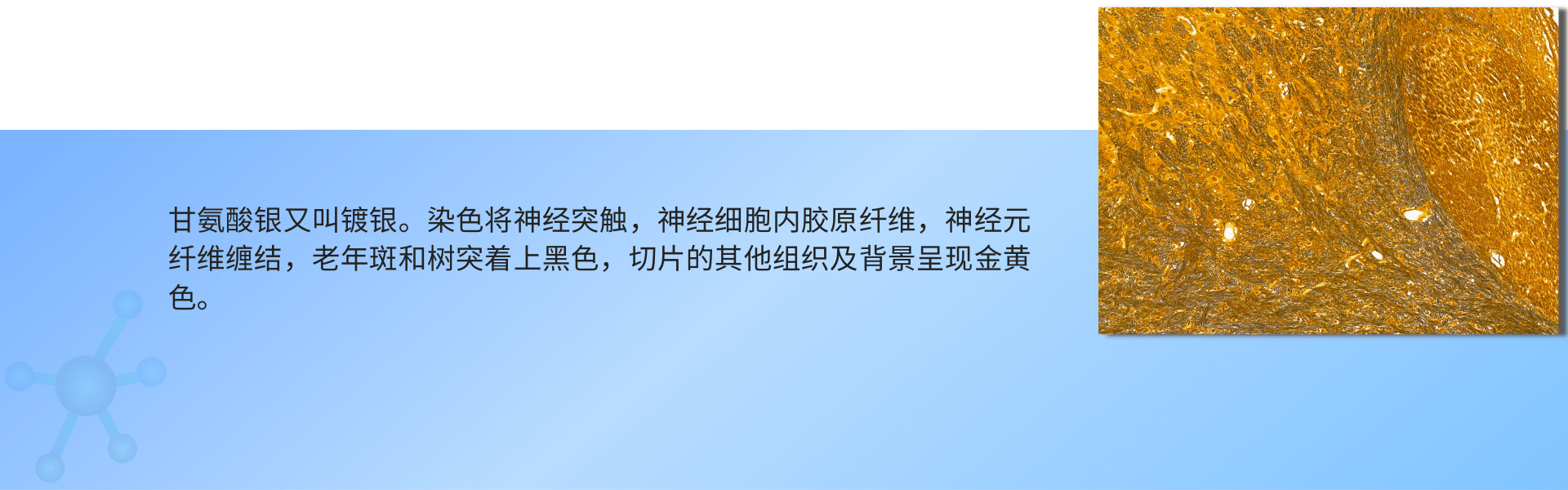 镀银染色 (2).png