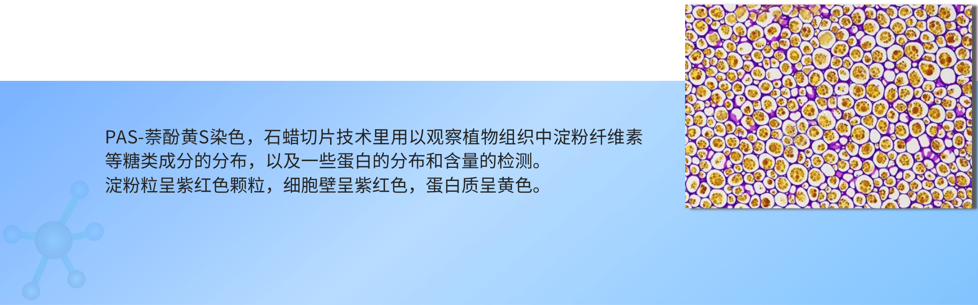 PAS-萘酚磺S染色 (1).png