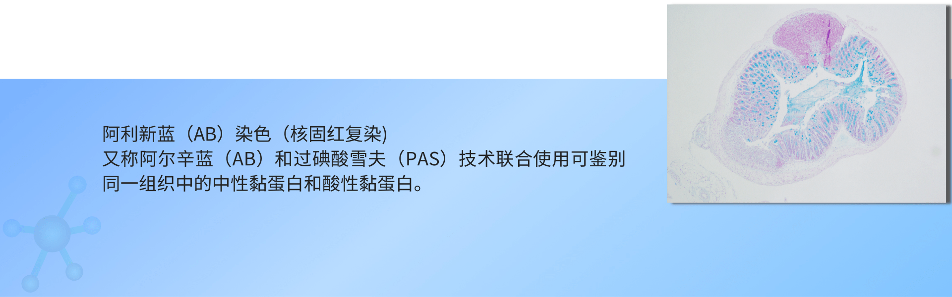 阿利新蓝（AB）染色（核固红复染).png