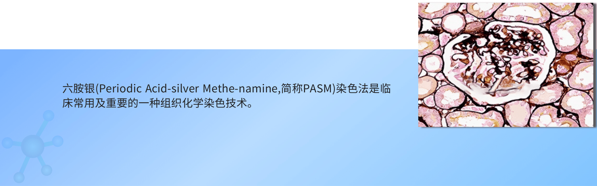 PASM 六胺银染色.png