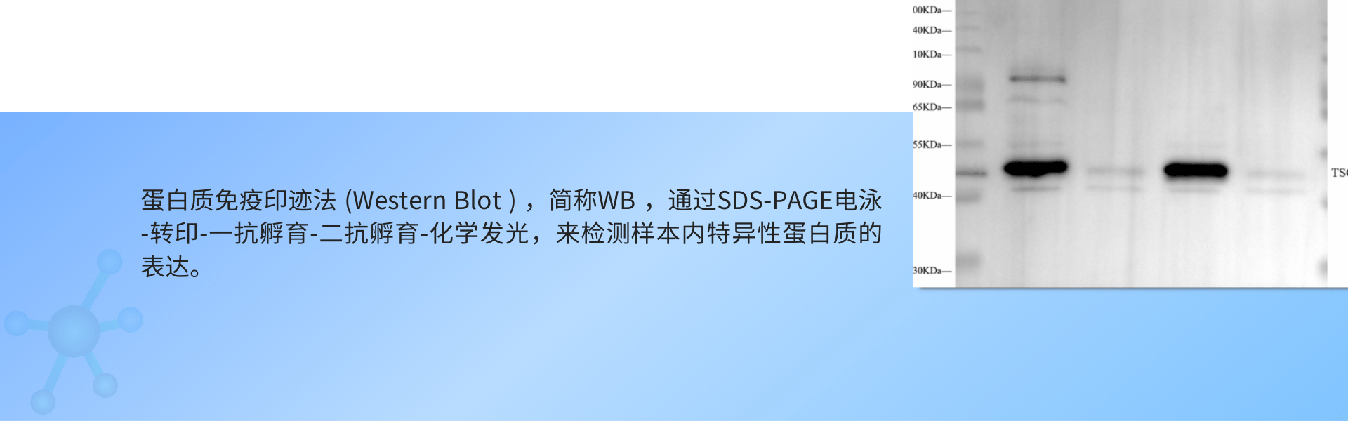 WB(外泌体).png