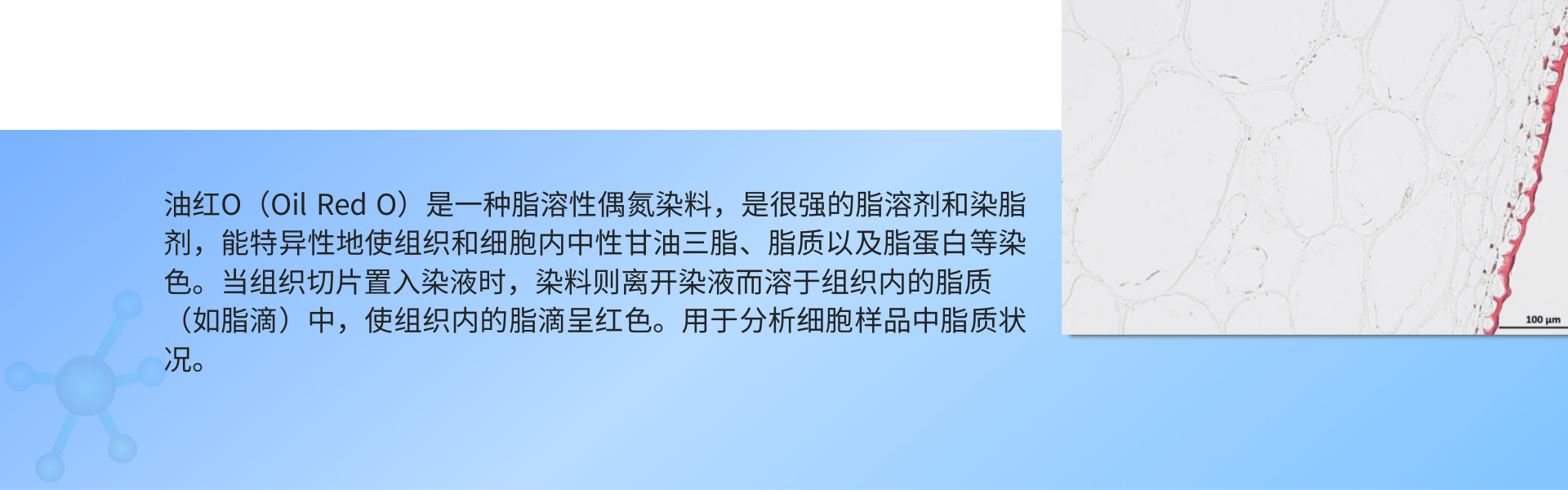 蜡质叶片油红O染色.png